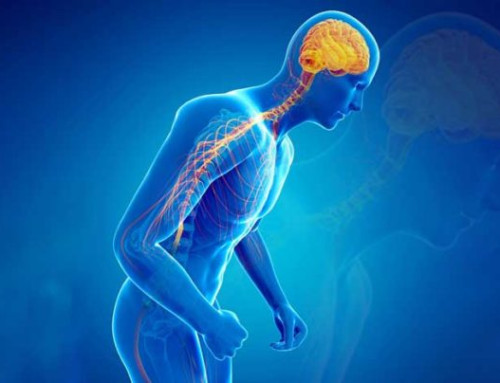 How Exercise Can Help With The Fight Against Parkinson’s Disease by Christian Fortin